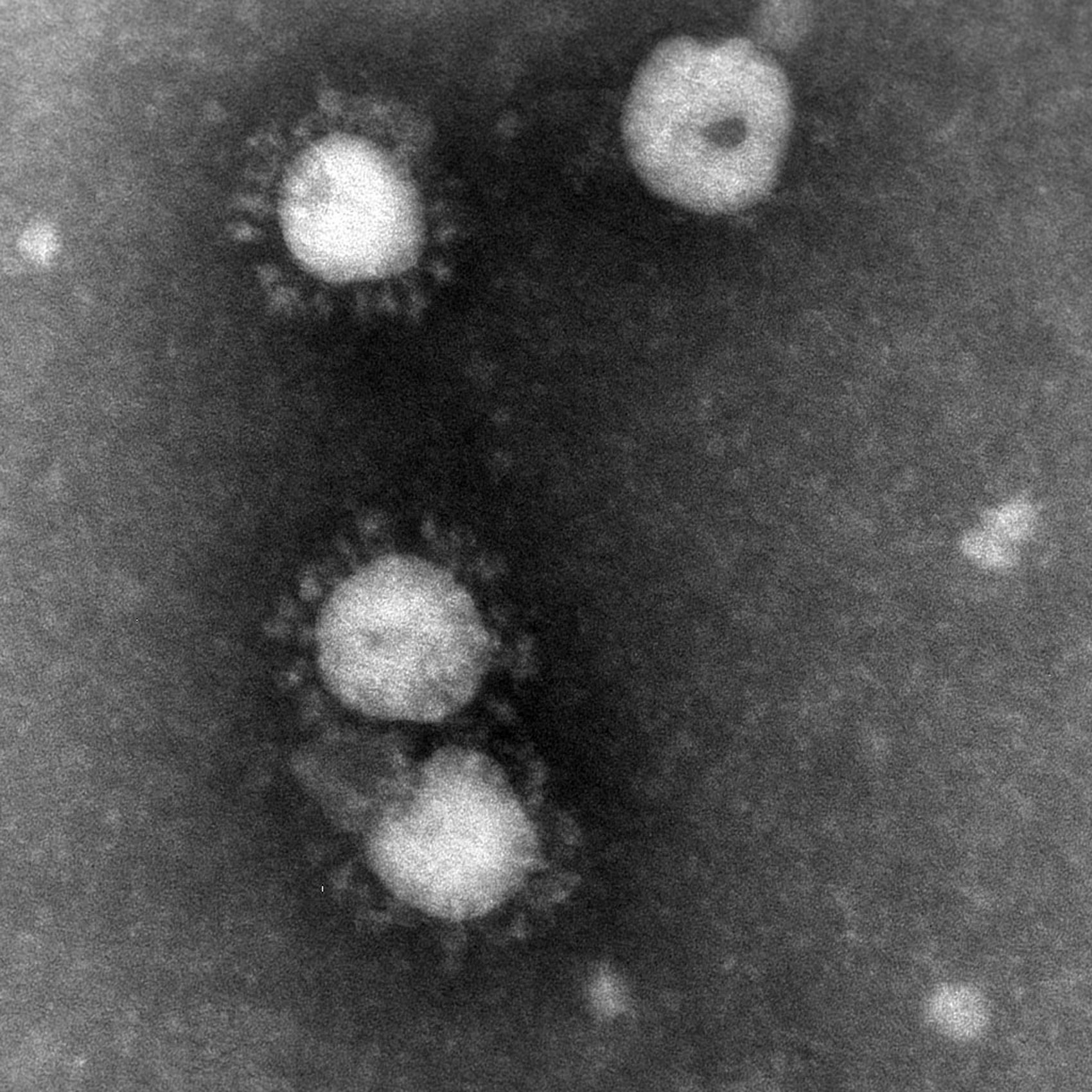 Coronavirus. Foto Folkhälsomyndigheten